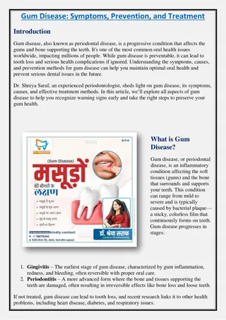 Treatment of Gum Disease - Saraf dental clinic