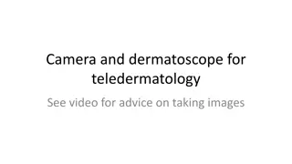 Guide to Using Camera and Dermatoscope for Teledermatology