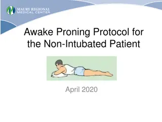 Awake Proning Protocol for Non-Intubated Patients