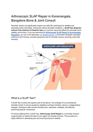 Arthroscopic SLAP Repair in Koramangala, Bangalore Bone & Joint Consult