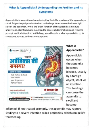 What is Appendicitis Dr Vaibhav Raj Singh