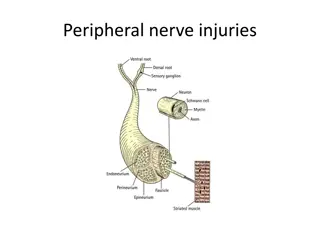 Understanding Peripheral Nerve Injuries and Pathological Classification