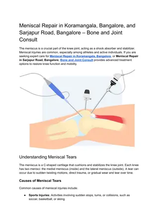 Meniscal Repair in Koramangala, Bangalore, and Sarjapur Road, Bangalore – Bone and Joint Consult