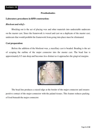 Overview of Prosthodontics Laboratory Procedures in RPD Construction