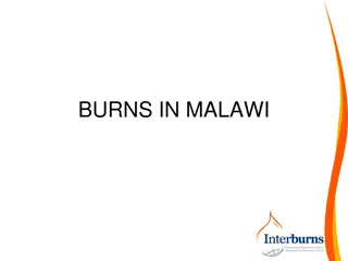 Challenges and Advancements in Burns Care in Malawi