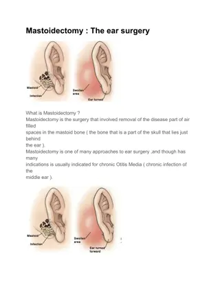 Best Mastoidectomy surgery hospital in bangalore