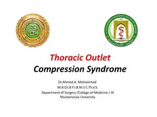 Thoracic Outlet Compression Syndrome