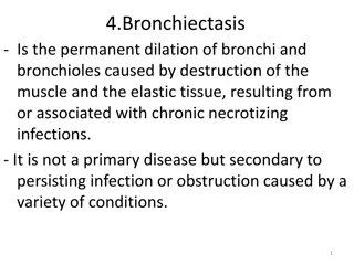 4.Bronchiectasis