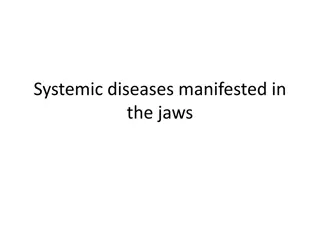 Overview of Jaws Manifestation in Systemic Diseases