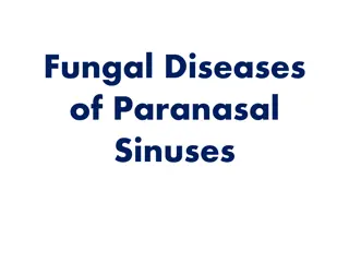 Fungal Diseases  of Paranasal