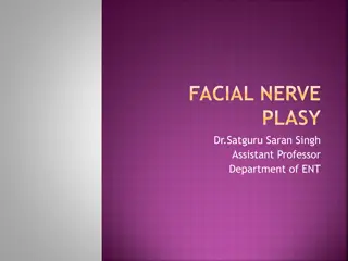 FACIAL NERVE  PLASY