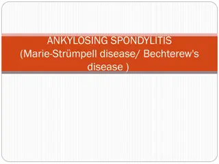 ANKYLOSING SPONDYLITIS