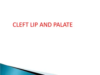 CLEFT LIP AND PALATE