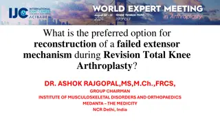 Preferred Option for Reconstruction of Failed Extensor Mechanism in Revision Total Knee Arthroplasty