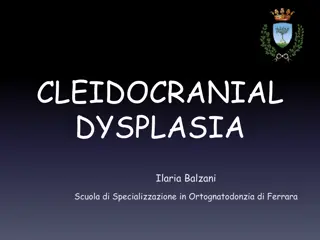 CLEIDOCRANIAL DYSPLASIA