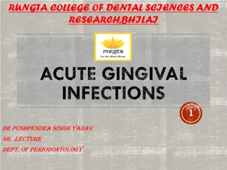 Acute Gingival Infections and Their Clinical Features