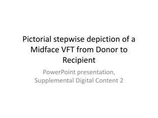 Stepwise Midface VFT Procedure Illustration