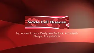 SICKLE CELL DISEASE