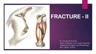 FRACTURE  FRACTURE - - II II