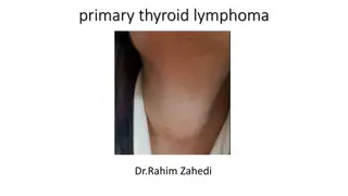 primary thyroid lymphoma