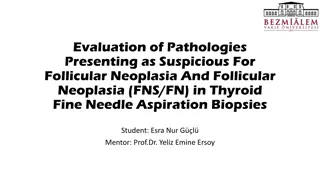 Evaluation of Pathologies Presenting as Suspicious for Follicular Neoplasia and Follicular Neoplasia in Thyroid Fine Needle Aspiration Biopsies