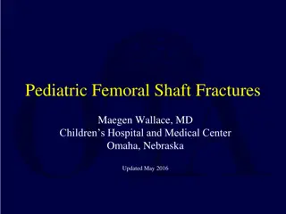 Pediatric Femoral Shaft Fractures