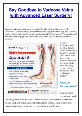 Say Goodbye to Varicose Veins with Advanced Laser Surgery - Dr Vaibhav Raj Singh