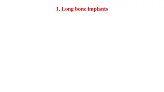 Long Bone Implants and Osteosynthesis Techniques