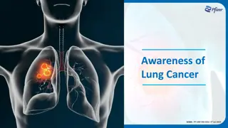 Lung Cancer Screening Programs and Criteria