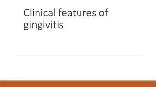 Clinical Features and Types of Gingivitis