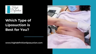 Which Type of Liposuction is Best for You - High Definition Liposuction