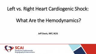 Hemodynamics in Left vs. Right Heart and Cardiogenic Shock