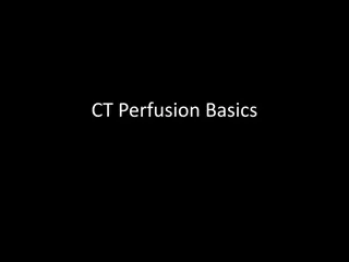 Basic CT Perfusion Terms in Stroke Imaging