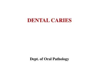 Enamel Caries: Zones and Histopathology