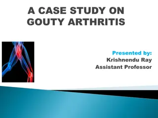 Case Study: Diagnosis and Management of Gouty Arthritis in a Middle-Aged Male